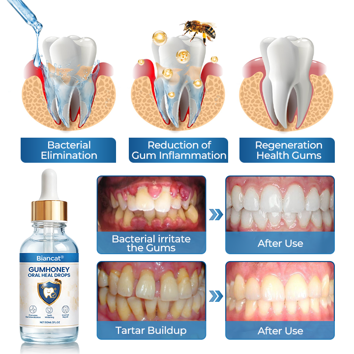 Biancat® GumHoney Oral Repair Drops (A)