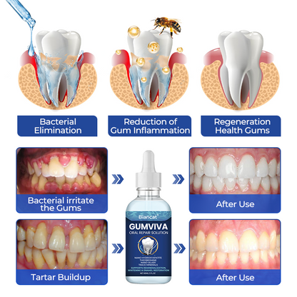Biancat® GumViva Oral Repair Solution(A)