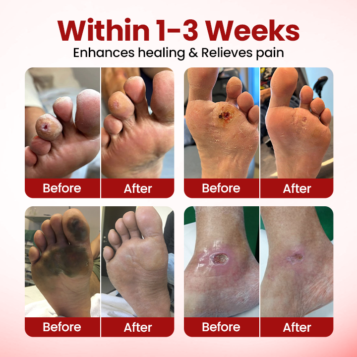 Timilk® VitaGluco Diabetic Care Cream (A) ✨