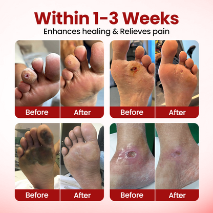 Timilk® VitaGluco Diabetic Care Cream (A) ✨