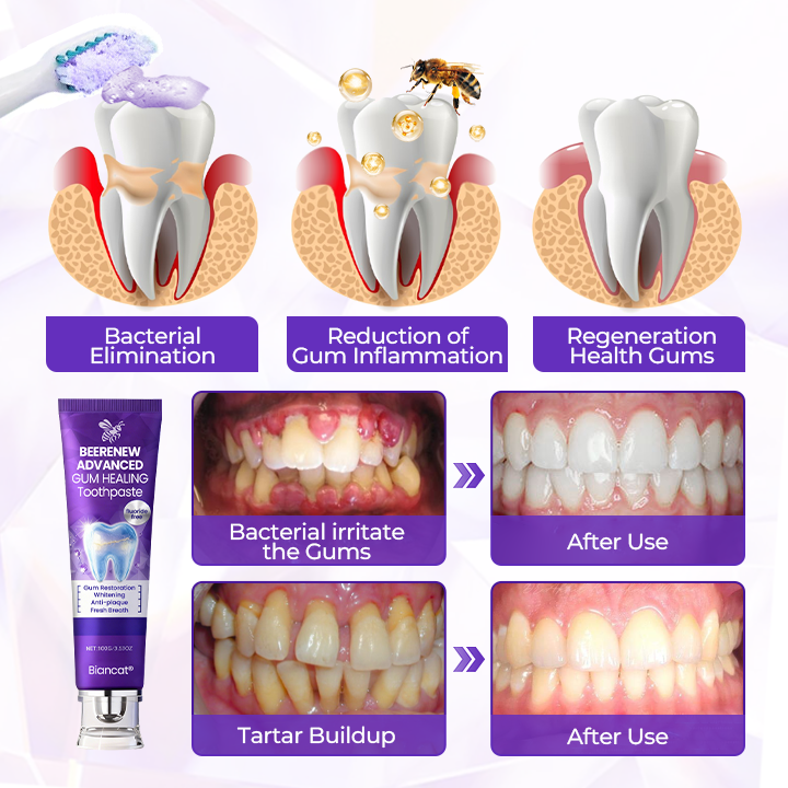 Biancat® BeeRenew Advanced Gum Healing Toothpaste✨（A）