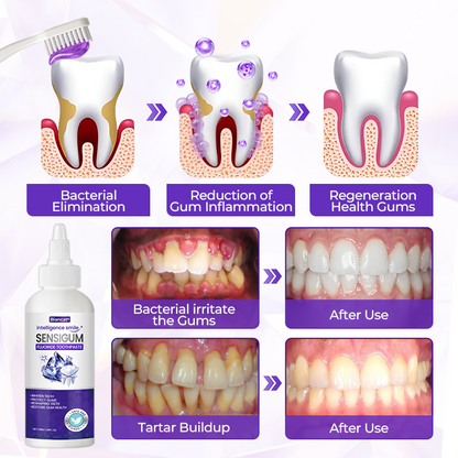 Biancat® SensiGum Fluoride Toothpaste🔥