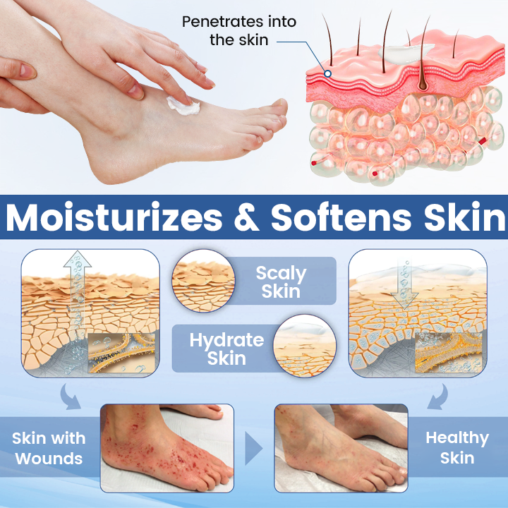 Timilk® AngioVita Diabetic Care Spray (A) ✨