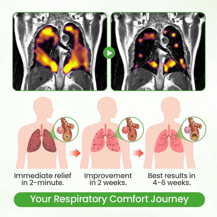 Timilk® HerbaAir Mullein Lung Purifier ✨