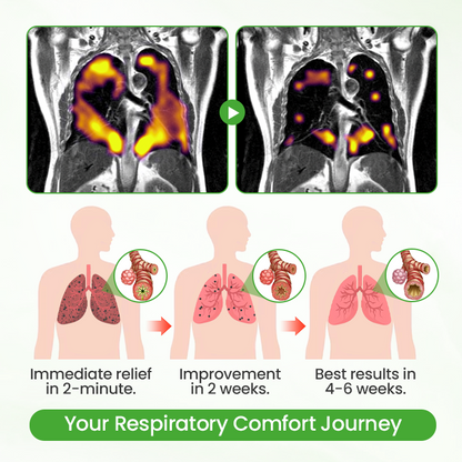 Timilk® HerbaAir Mullein Lung Purifier ✨