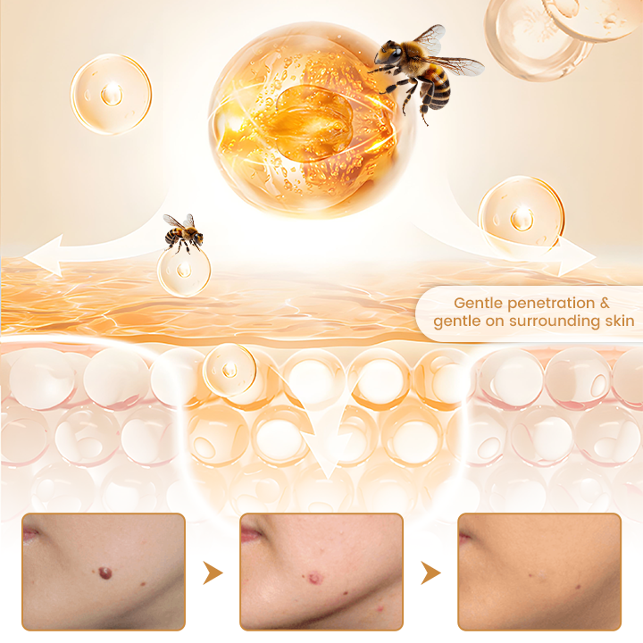 Biancat® BeeVenom Wart Drop Serum ✨