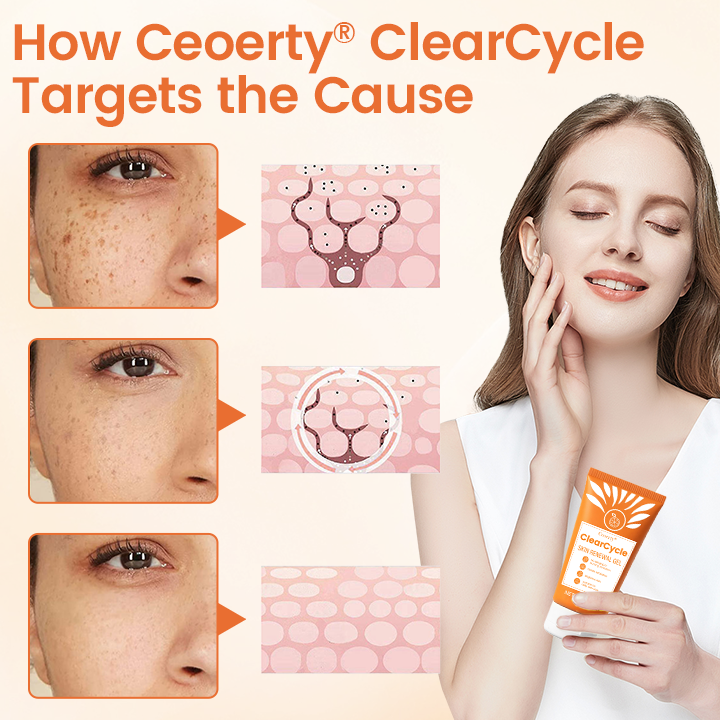 Ceoerty® ClearCycle Skin Renewal Gel ✨