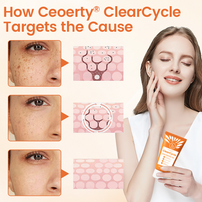 Ceoerty® ClearCycle Skin Renewal Gel ✨