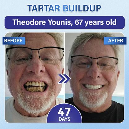 Your Smile🦷Ceoerty® Tooth & Gum Repair Fast-Dissolving Microneedle Patch✨ (𝟓-𝐢𝐧-𝟏 💎 𝐑𝐞𝐛𝐮𝐢𝐥𝐝 𝐄𝐧𝐚𝐦𝐞𝐥 & 𝐃𝐞𝐧𝐭𝐢𝐧 • 𝐒𝐭𝐫𝐞𝐧𝐠𝐭𝐡𝐞𝐧 𝐆𝐮𝐦𝐬 • 𝐄𝐫𝐚𝐝𝐢𝐜𝐚𝐭𝐞 𝐓𝐚𝐫𝐭𝐚𝐫 & 𝐎𝐝𝐨𝐫 • 𝐖𝐡𝐢𝐭𝐞𝐧𝐢𝐧𝐠 • 𝐒𝐭𝐨𝐩 𝐓𝐨𝐨𝐭𝐡 𝐒𝐞𝐧𝐬𝐢𝐭𝐢𝐯𝐢𝐭𝐲)✨