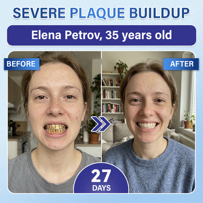 Your Smile🦷Ceoerty® Tooth & Gum Repair Fast-Dissolving Microneedle Patch✨ (𝟓-𝐢𝐧-𝟏 💎 𝐑𝐞𝐛𝐮𝐢𝐥𝐝 𝐄𝐧𝐚𝐦𝐞𝐥 & 𝐃𝐞𝐧𝐭𝐢𝐧 • 𝐒𝐭𝐫𝐞𝐧𝐠𝐭𝐡𝐞𝐧 𝐆𝐮𝐦𝐬 • 𝐄𝐫𝐚𝐝𝐢𝐜𝐚𝐭𝐞 𝐓𝐚𝐫𝐭𝐚𝐫 & 𝐎𝐝𝐨𝐫 • 𝐖𝐡𝐢𝐭𝐞𝐧𝐢𝐧𝐠 • 𝐒𝐭𝐨𝐩 𝐓𝐨𝐨𝐭𝐡 𝐒𝐞𝐧𝐬𝐢𝐭𝐢𝐯𝐢𝐭𝐲)✨