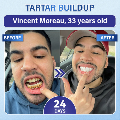 Your Smile🦷Ceoerty® Tooth & Gum Repair Fast-Dissolving Microneedle Patch✨ (𝟓-𝐢𝐧-𝟏 💎 𝐑𝐞𝐛𝐮𝐢𝐥𝐝 𝐄𝐧𝐚𝐦𝐞𝐥 & 𝐃𝐞𝐧𝐭𝐢𝐧 • 𝐒𝐭𝐫𝐞𝐧𝐠𝐭𝐡𝐞𝐧 𝐆𝐮𝐦𝐬 • 𝐄𝐫𝐚𝐝𝐢𝐜𝐚𝐭𝐞 𝐓𝐚𝐫𝐭𝐚𝐫 & 𝐎𝐝𝐨𝐫 • 𝐖𝐡𝐢𝐭𝐞𝐧𝐢𝐧𝐠 • 𝐒𝐭𝐨𝐩 𝐓𝐨𝐨𝐭𝐡 𝐒𝐞𝐧𝐬𝐢𝐭𝐢𝐯𝐢𝐭𝐲)✨