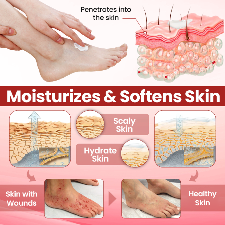 Timilk® VitaGluco Diabetic Care Cream (A) ✨