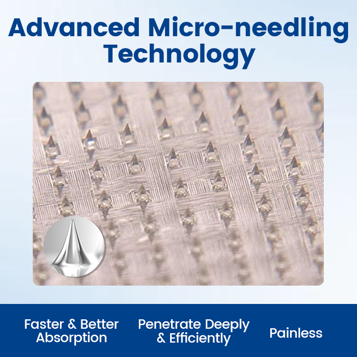 Timilk® Vein Ease Microneedle Therapy Patch - Fast ⚡Effective 💪 and Non-Invasive 🚫 Treatment for Varicose Veins & Leg Swelling 👣