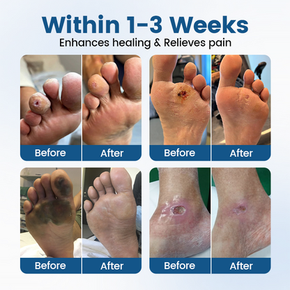 Timilk® AngioVita Diabetic Care Spray (A) ✨