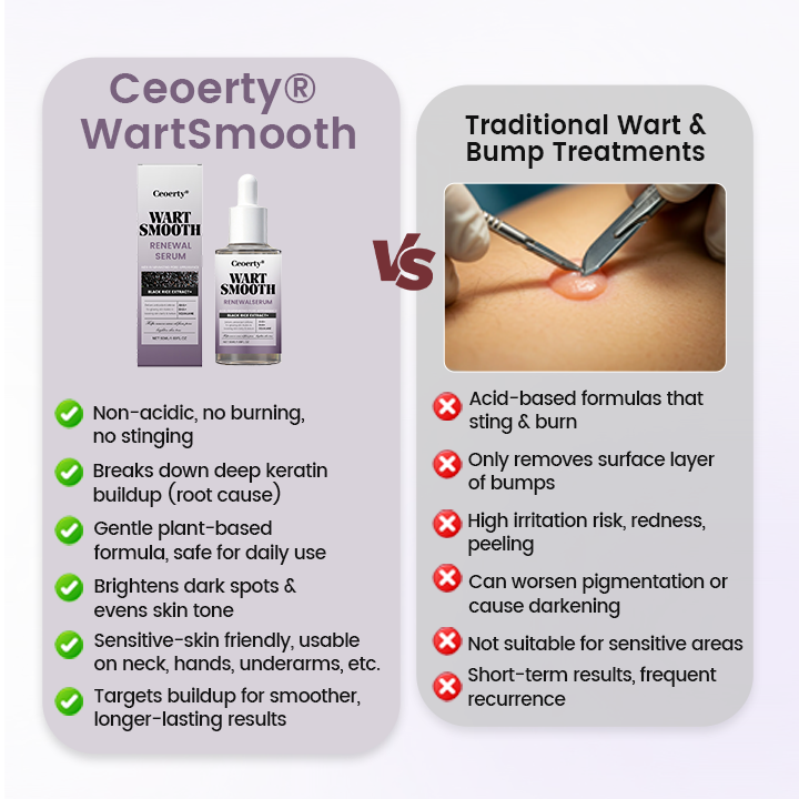 Ceoerty® WartSmooth Renewal Serum
