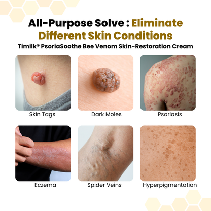 Timilk® PsoriaSoothe Bee Venom Skin-Restoration Cream🔥