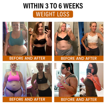 Timilk® SlimFlow Bee Venom Lymphatic Detox Foot Patches（A）✨