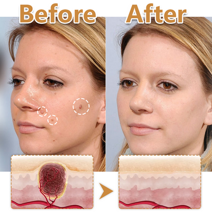 Biancat® BeeVenom Wart Drop Serum ✨