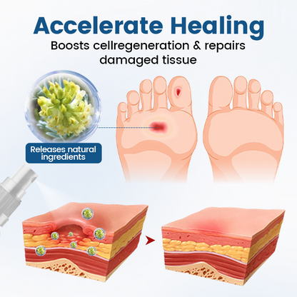 Timilk® AngioVita Diabetic Care Spray (A) ✨