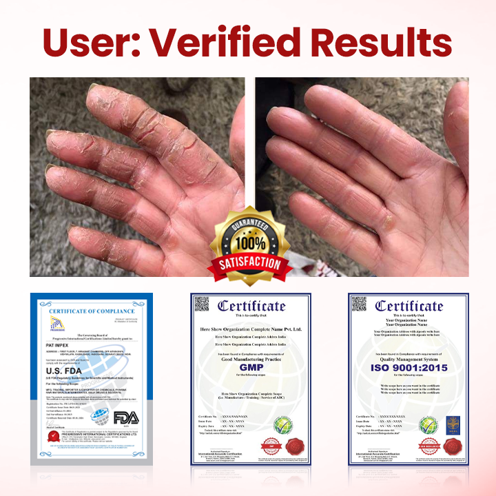 Timilk® VitaGluco Diabetic Care Cream (A) ✨