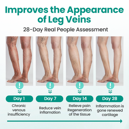 Timilk® LegRenew Varicose Veins Patch ✨