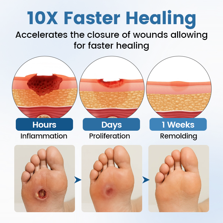 Timilk® AngioVita Diabetic Care Spray (A) ✨