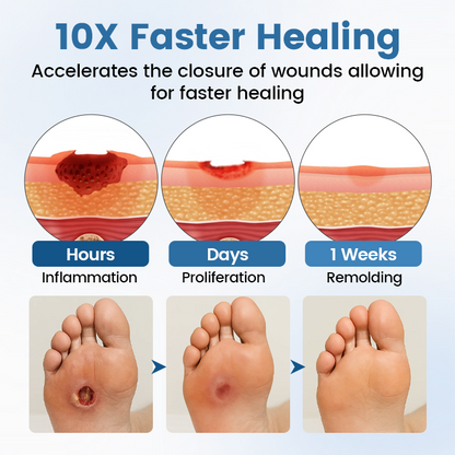 Timilk® AngioVita Diabetic Care Spray (A) ✨