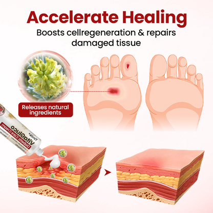 Timilk® VitaGluco Diabetic Care Cream (A) ✨