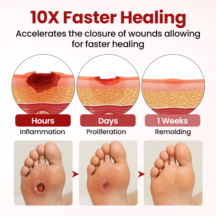 Timilk® VitaGluco Diabetic Care Cream (A) ✨