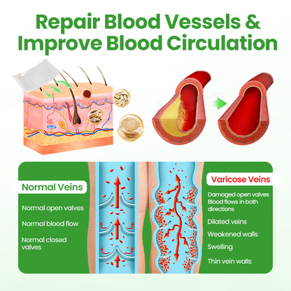 Healrize® VeinHeal Microneedle Patch ✨